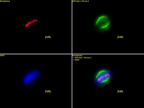 Aurora B Antibody in Immunocytochemistry (ICC/IF)