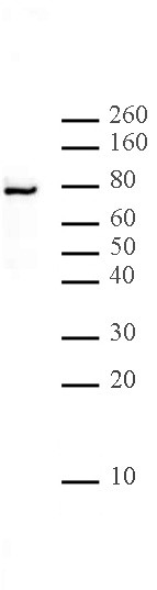 LAP2 alpha Antibody in Western Blot (WB)