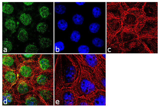 PPP2R5C Antibody in Immunocytochemistry (ICC/IF)