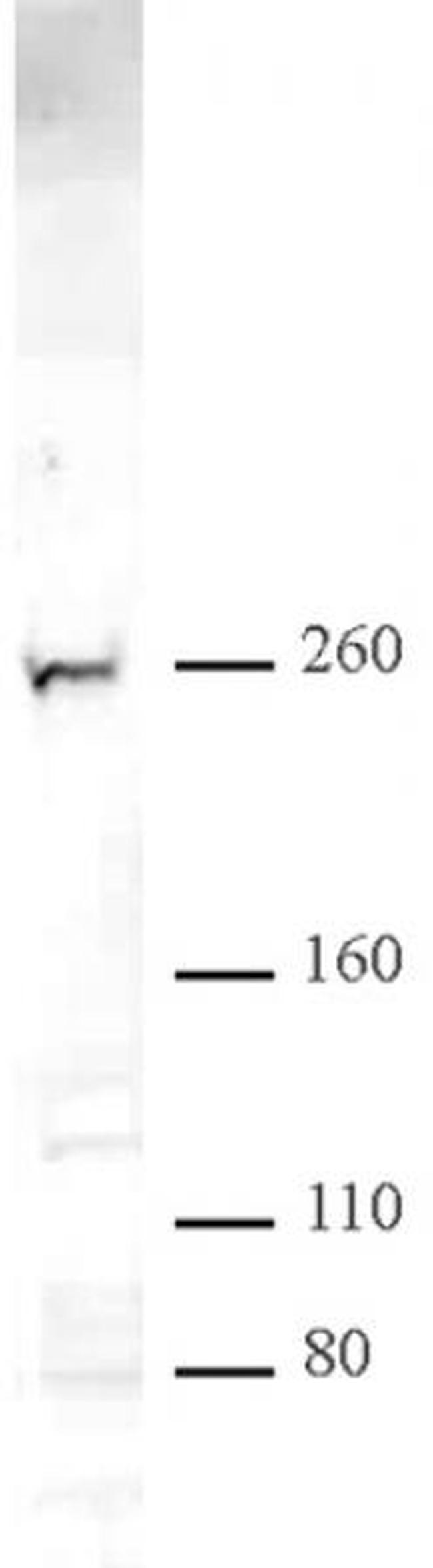CHD2 Antibody in Western Blot (WB)