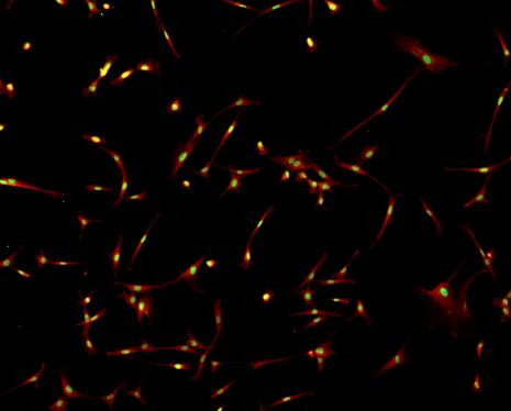 NF-1A Antibody in Immunocytochemistry (ICC/IF)