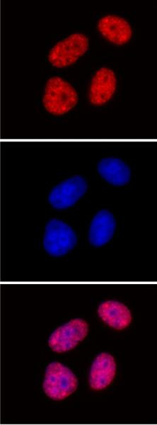 Histone H3K27me2me3 Antibody in Immunocytochemistry (ICC/IF)