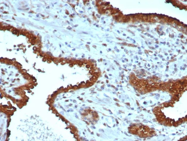Galectin-3 (LGALS3) (Thyroid Cell Marker) Antibody in Immunohistochemistry (Paraffin) (IHC (P))