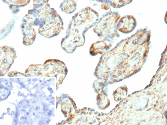 Galectin-3 (LGALS3) (Thyroid Cell Marker) Antibody in Immunohistochemistry (Paraffin) (IHC (P))