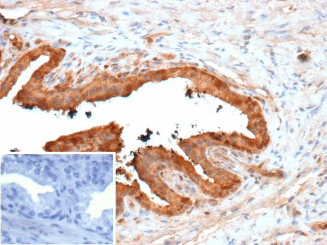 Galectin-3 (LGALS3) (Thyroid Cell Marker) Antibody in Immunohistochemistry (Paraffin) (IHC (P))