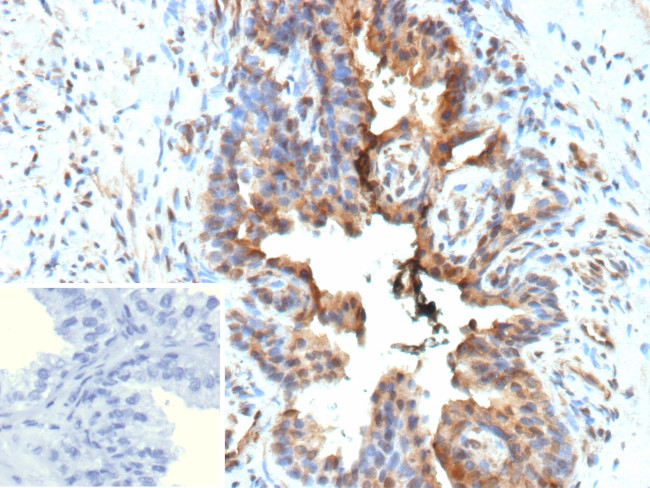 Galectin-3 (LGALS3) (Thyroid Cell Marker) Antibody in Immunohistochemistry (Paraffin) (IHC (P))