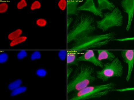 Histone H3K18ac Antibody in Immunocytochemistry (ICC/IF)