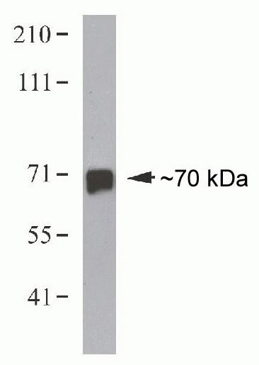 HEC1 Antibody in Western Blot (WB)