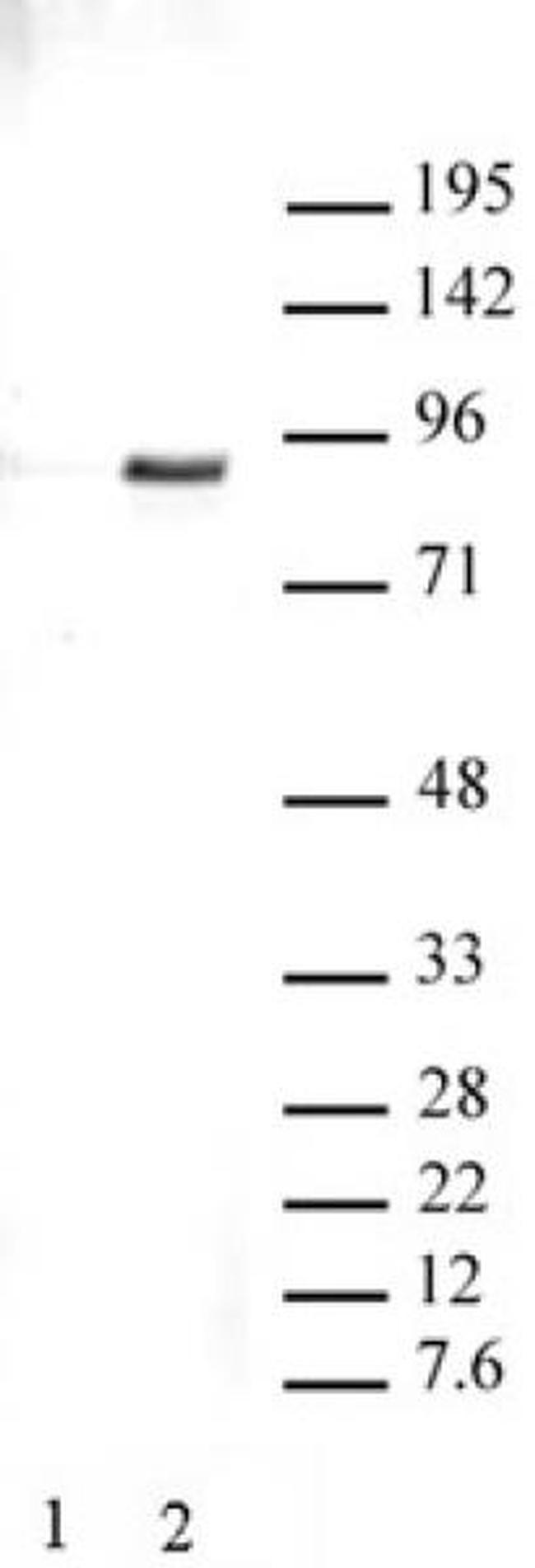 Phospho-STAT3 (Tyr705) Antibody in Western Blot (WB)