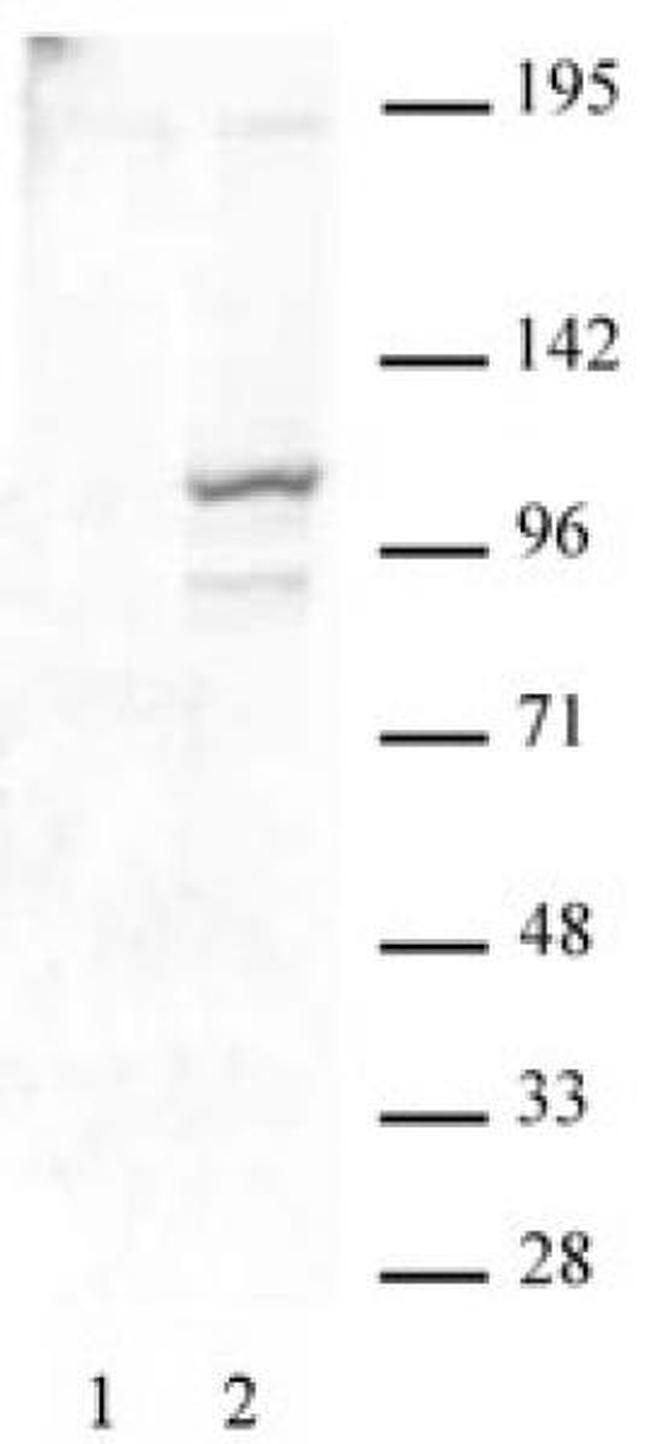 Phospho-STAT2 (Tyr689) Antibody in Western Blot (WB)