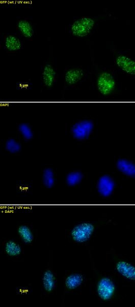 HMGA1 Antibody in Immunocytochemistry (ICC/IF)