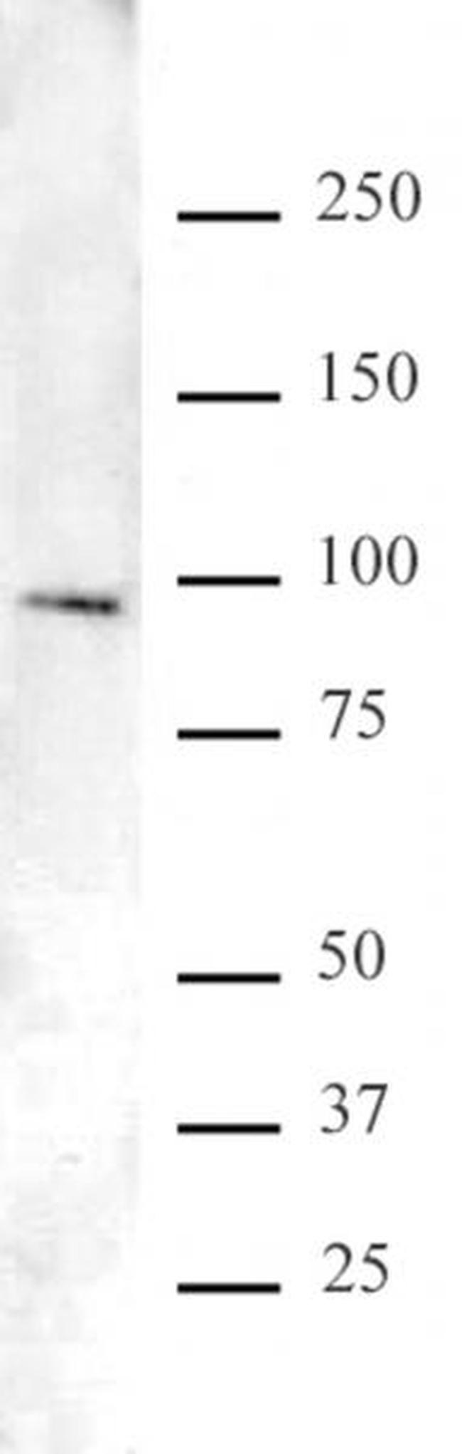 FOXO1/FKHR Antibody in Western Blot (WB)