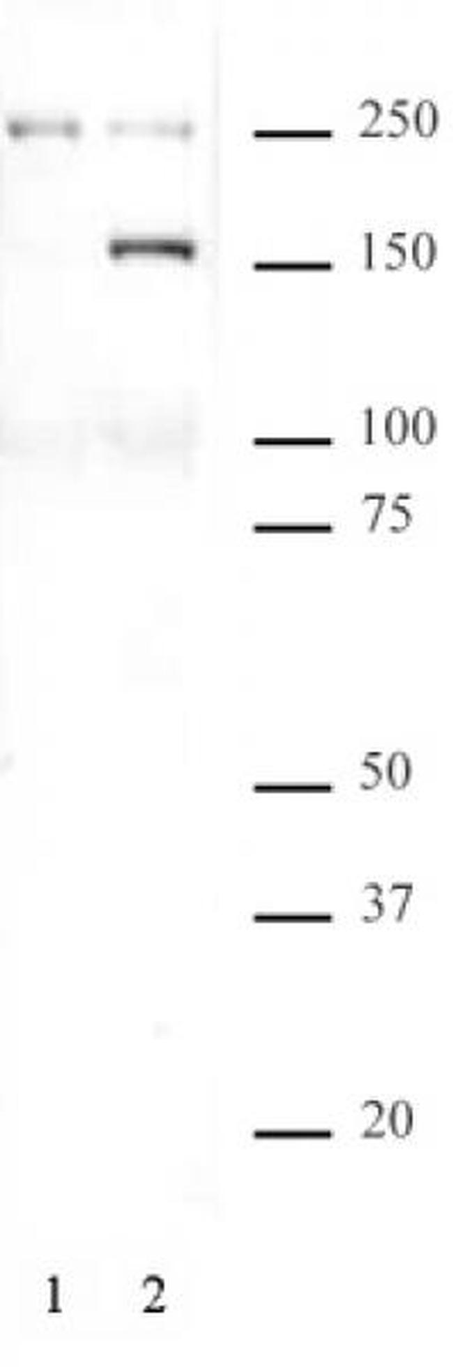 Phospho-SMC1 (Ser957) Antibody in Western Blot (WB)