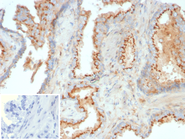 Galectin-9 (LGALS9) (Marker of T-Cell Exhaustion) Antibody in Immunohistochemistry (Paraffin) (IHC (P))