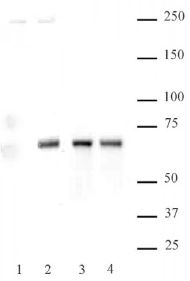Phospho-NFkB p65 (Ser536) Antibody in Western Blot (WB)
