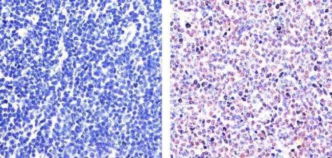 PAX5 Antibody in Immunohistochemistry (Paraffin) (IHC (P))