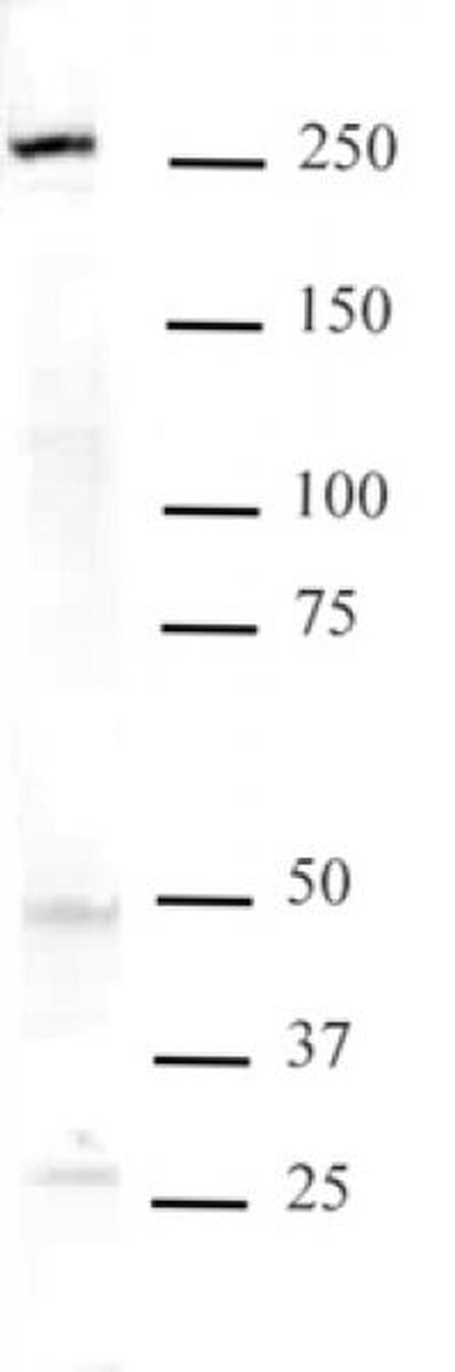 Mi-2 beta Antibody in Western Blot (WB)