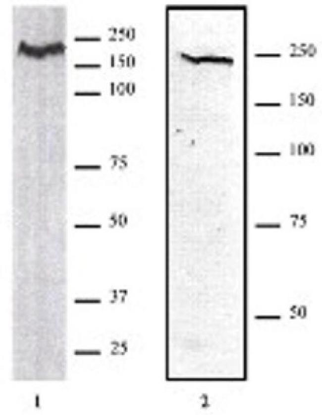 CHD1 Antibody in Western Blot (WB)