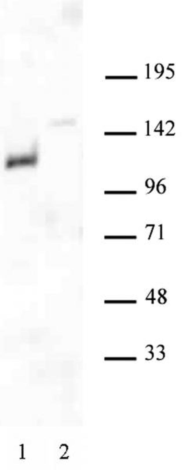 Androgen Receptor Antibody in Western Blot (WB)