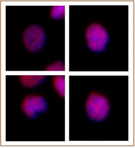 MEIS 1/2/3 Antibody in Immunocytochemistry (ICC/IF)