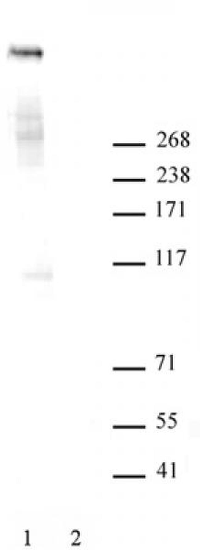 Ki-67 Antibody in Western Blot (WB)