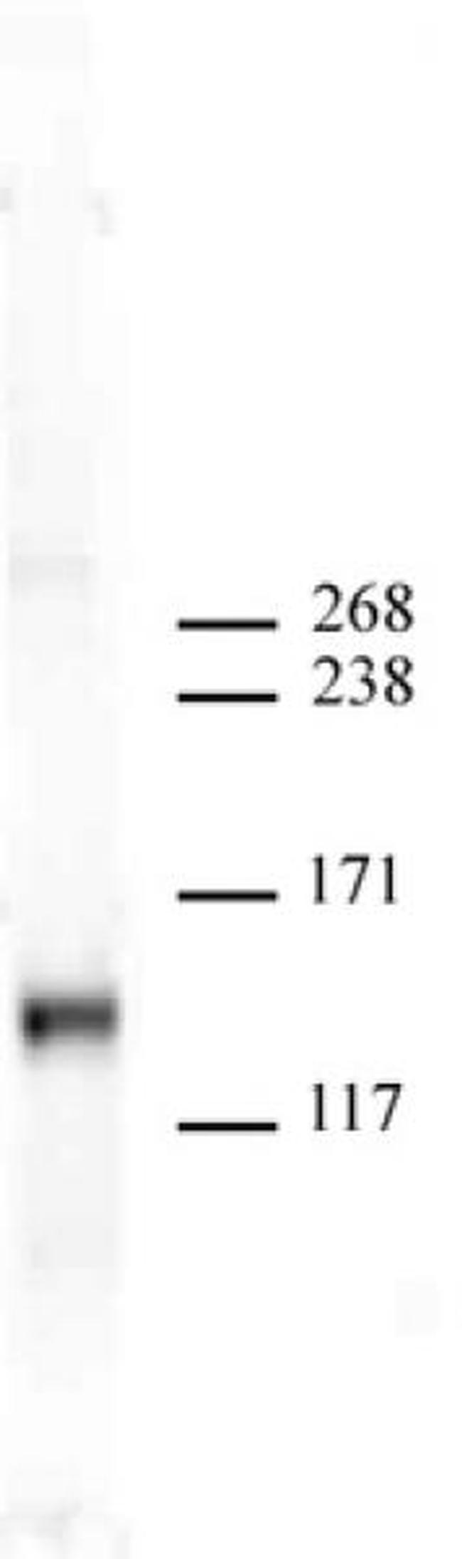 JMJD2A Antibody in Western Blot (WB)