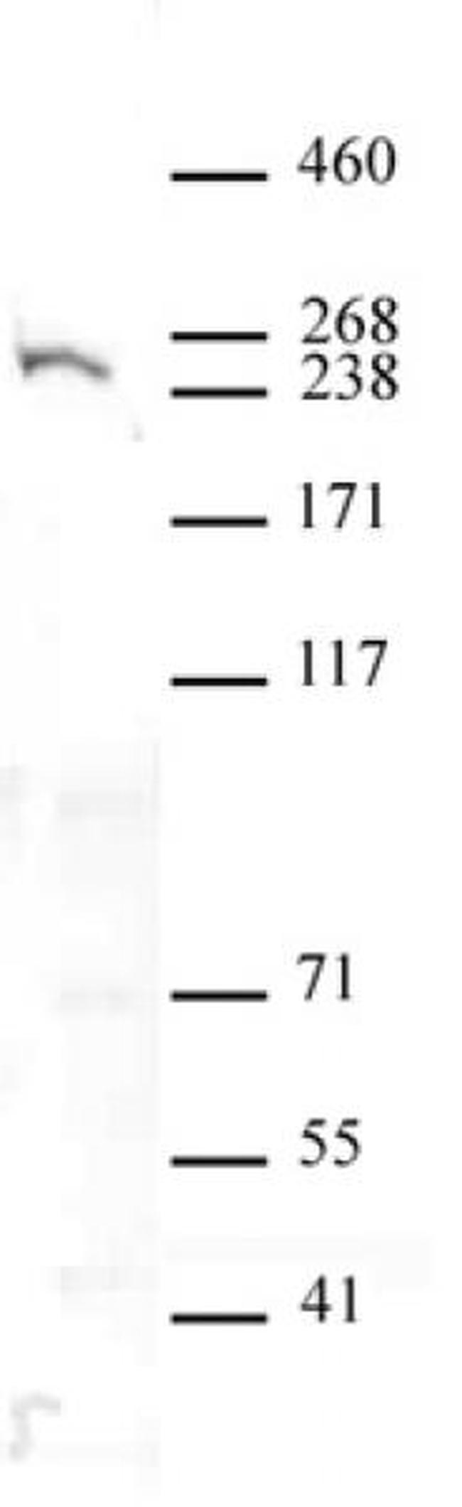 Dicer Antibody in Western Blot (WB)
