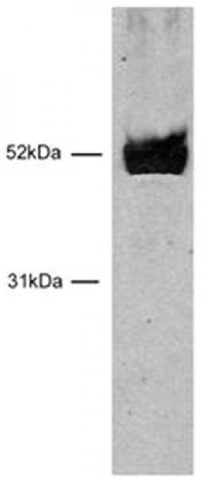 HNF-3 beta / FOXA2 Antibody in Western Blot (WB)
