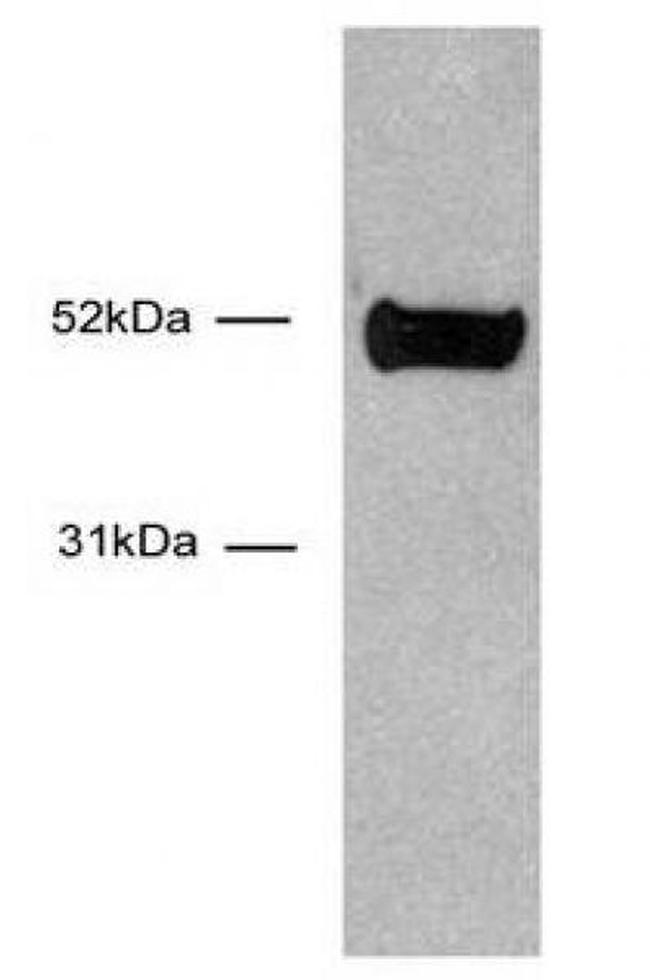 HNF-3 alpha / FOXA1 Antibody in Western Blot (WB)