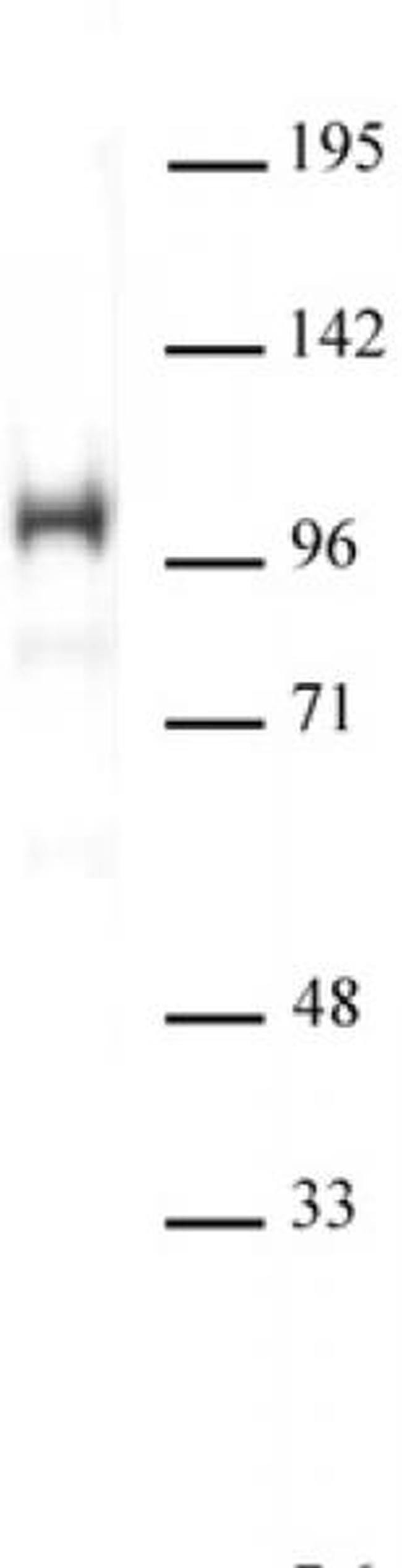 SATB1 Antibody in Western Blot (WB)