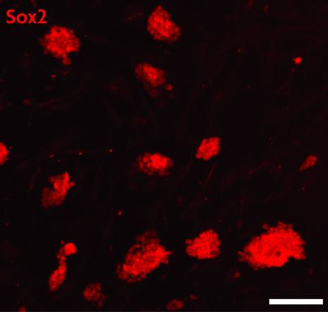 Sox2 Antibody in Immunocytochemistry (ICC/IF)