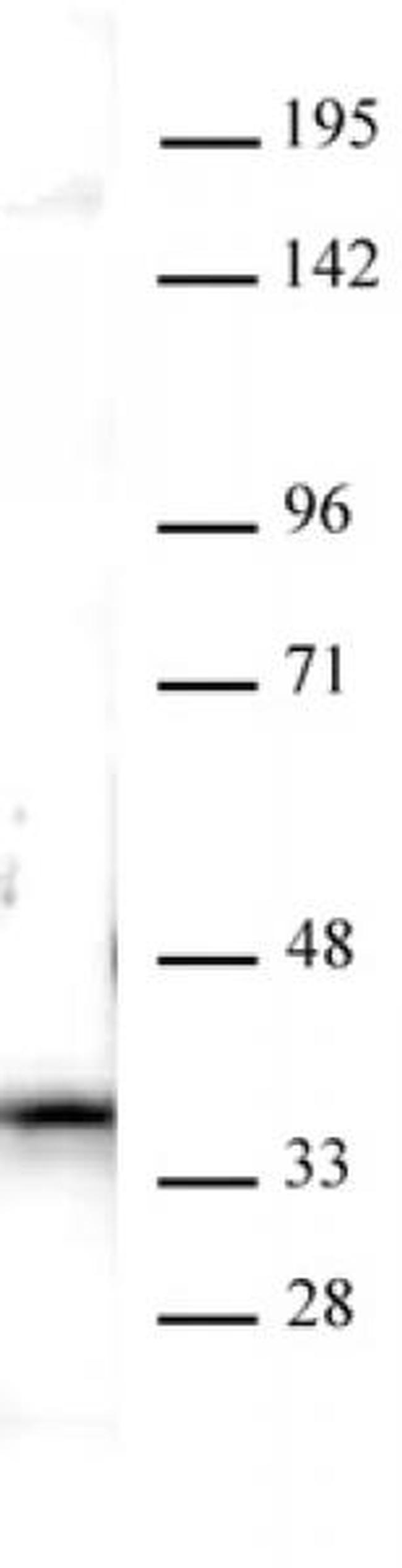 Nucleophosmin Antibody in Western Blot (WB)