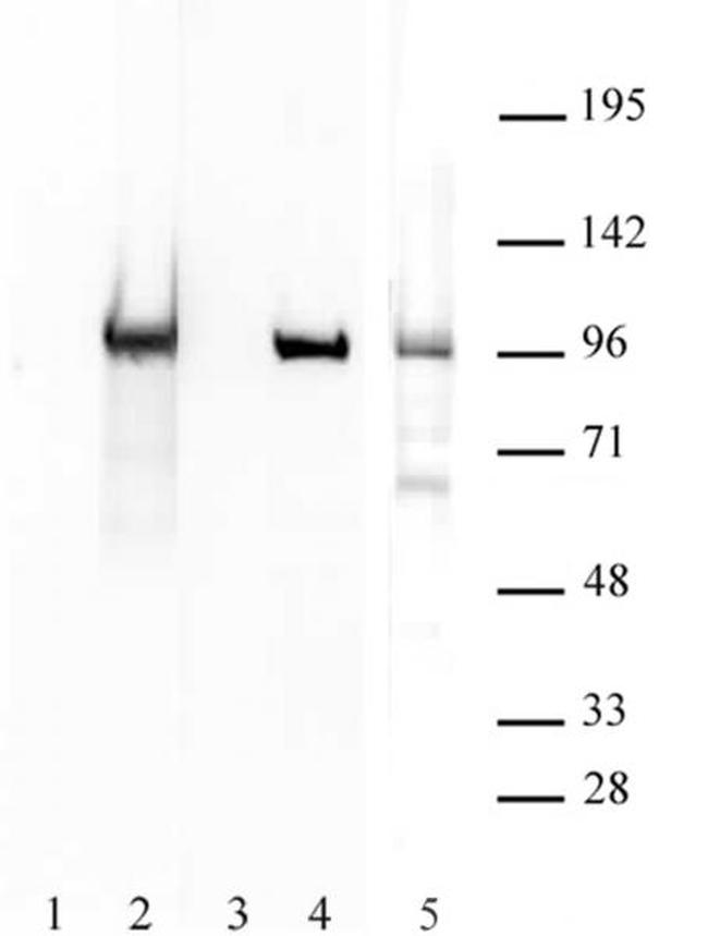 Boris / CTCFL Antibody in Western Blot (WB)