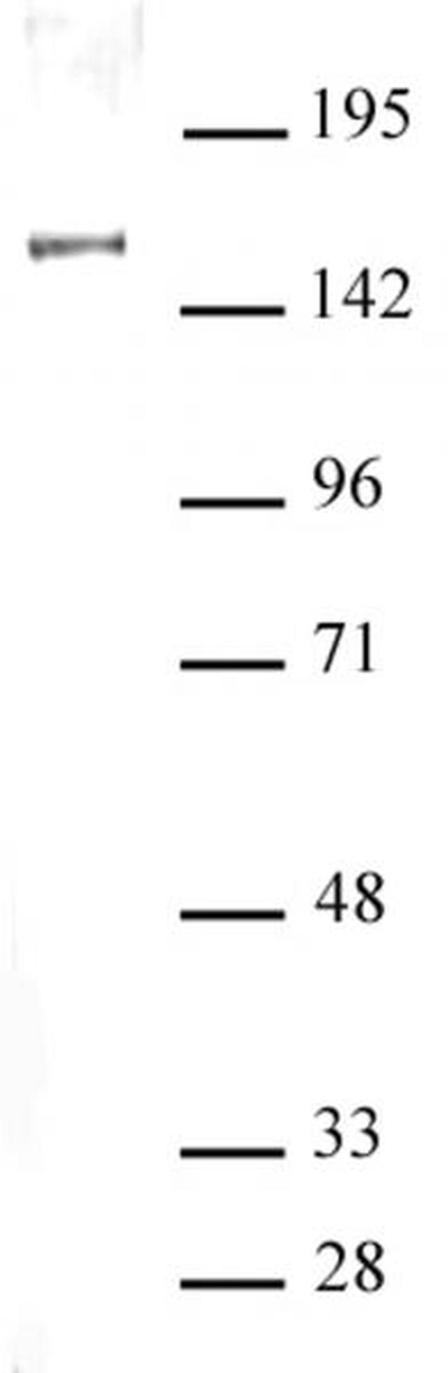 SIN3A Antibody in Western Blot (WB)
