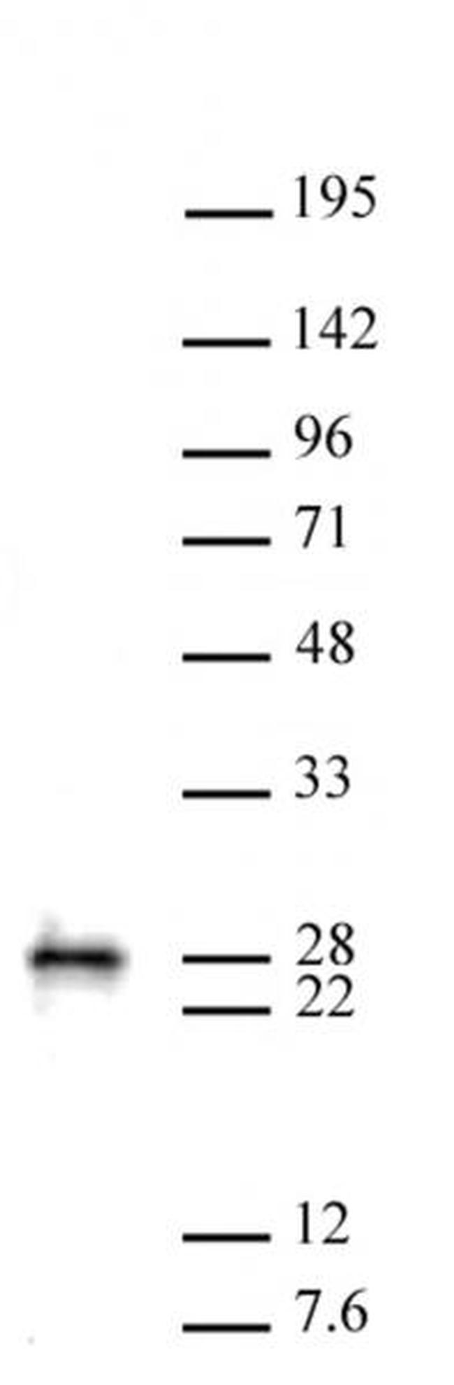 MGMT Antibody in Western Blot (WB)