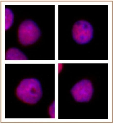 CAF-1 p60 Antibody in Immunocytochemistry (ICC/IF)