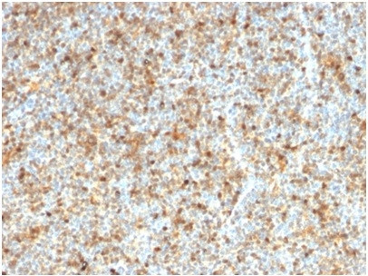 LMO2 (B-Cell Marker) Antibody in Immunohistochemistry (Paraffin) (IHC (P))