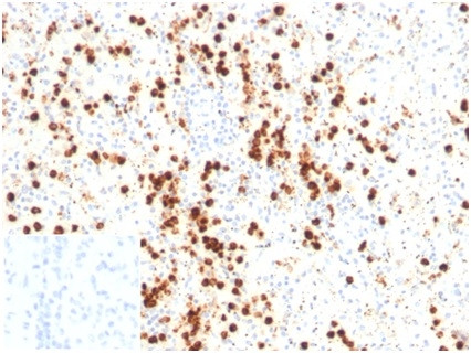 Lysozyme (Histiocytoma andMonocytic Acute Leukemia Marker) Antibody in Immunohistochemistry (Paraffin) (IHC (P))