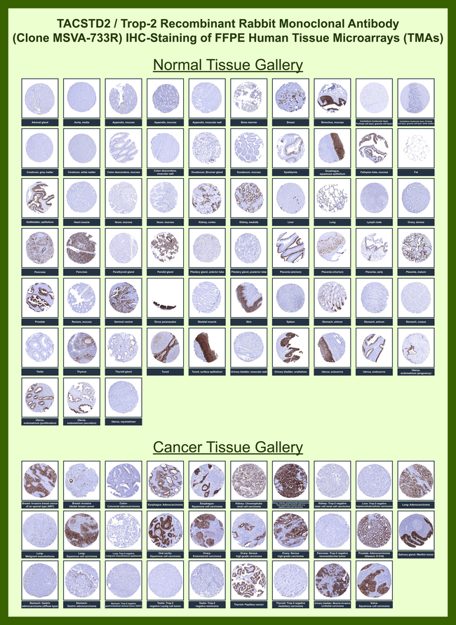 TACSTD2/TROP2 (Epithelial Marker) Antibody in Immunohistochemistry (Paraffin) (IHC (P))