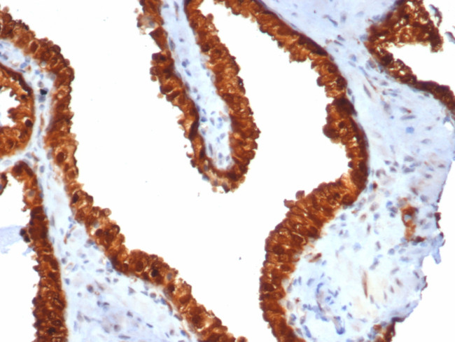 TACSTD2/TROP2 (Epithelial Marker) Antibody in Immunohistochemistry (Paraffin) (IHC (P))