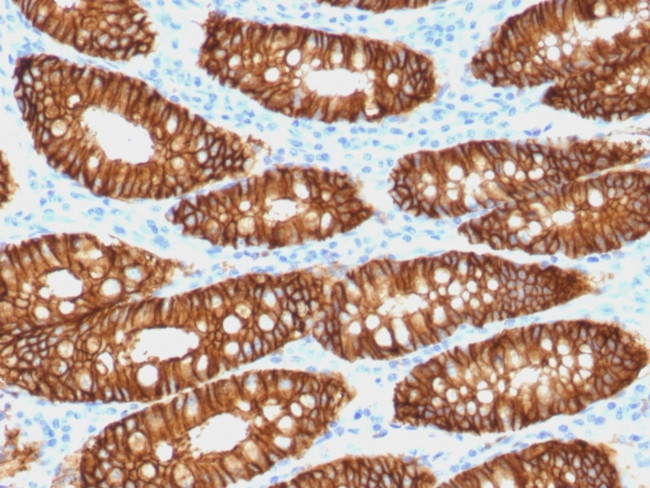 Ep-CAM/CD326 (Epithelial Marker) Antibody in Immunohistochemistry (Paraffin) (IHC (P))