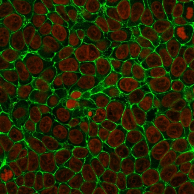 EpCAM/CD326 (Epithelial Marker) Antibody in Immunocytochemistry (ICC/IF)