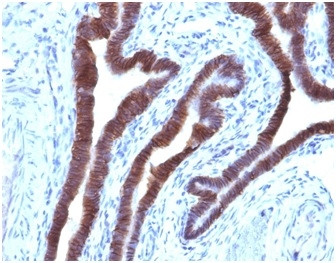 Ep-CAM/CD326 Antibody in Immunohistochemistry (Paraffin) (IHC (P))