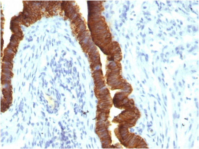 Ep-CAM/CD326 Antibody in Immunohistochemistry (Paraffin) (IHC (P))