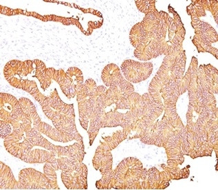 EpCAM/CD326 (Epithelial Marker) Antibody in Immunohistochemistry (Paraffin) (IHC (P))