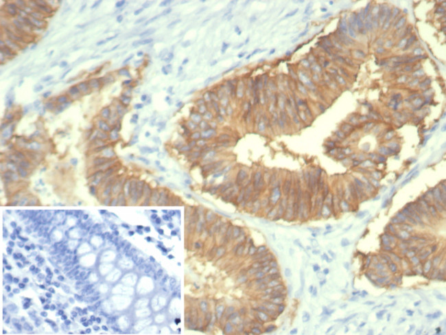EpCAM/CD326 (Epithelial Marker) Antibody in Immunohistochemistry (Paraffin) (IHC (P))