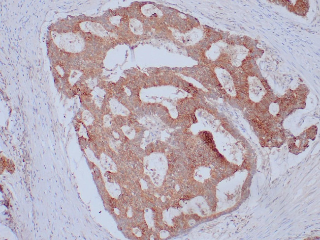 Ep-CAM/CD326 (Extracellular Domain) (Epithelial Marker) Antibody in Immunohistochemistry (Paraffin) (IHC (P))