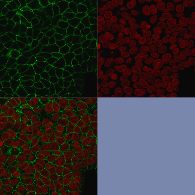Ep-CAM/CD326 (Epithelial Marker) Antibody in Immunocytochemistry (ICC/IF)