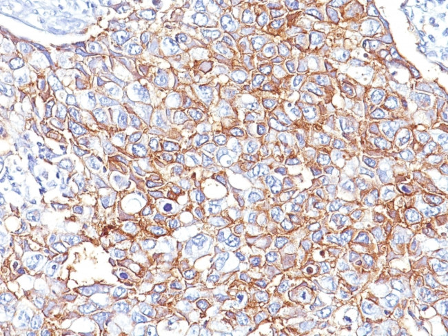 EpCAM/CD326 (Epithelial Marker) Antibody in Immunohistochemistry (Paraffin) (IHC (P))