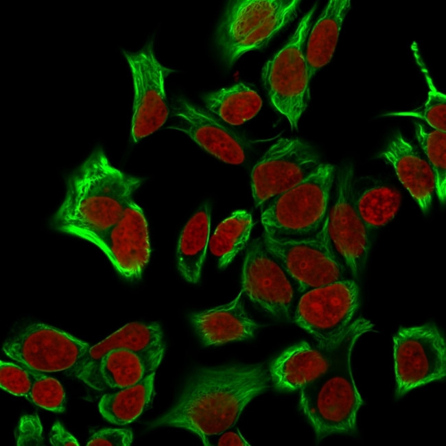EpCAM/CD326 (Epithelial Marker) Antibody in Immunocytochemistry (ICC/IF)